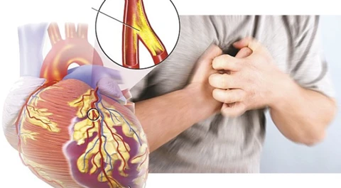 Tiểu đường ảnh hưởng đến tim mạch như thế nào?