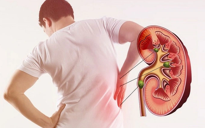 Tiểu đường ảnh hưởng đến thận như thế nào?