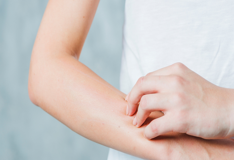 Ngứa da tiểu đường